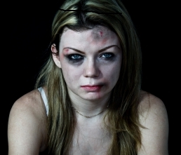 Picture of a battered woman