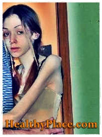 In this self-harm photo, a girl with anorexia also engages in self harm by banging and bruising parts of her body