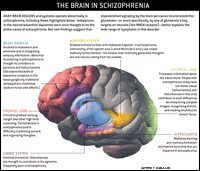 Schizophrenia Brain